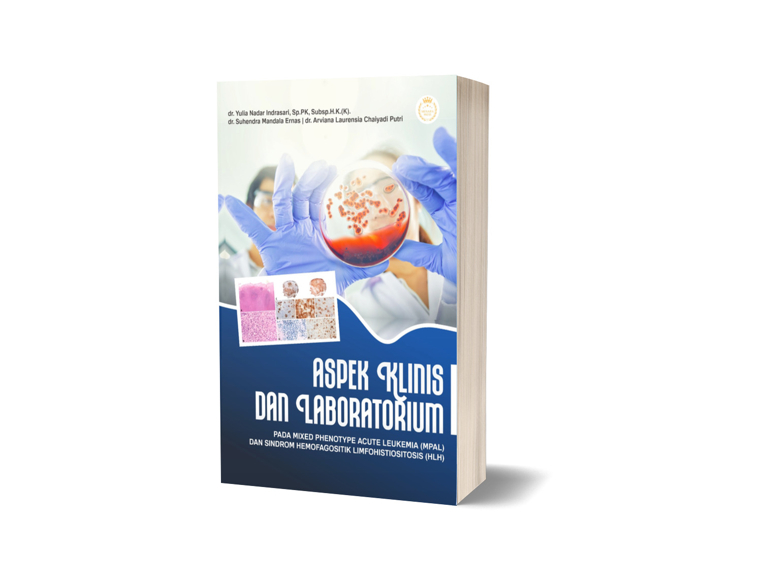 ASPEK KLINIS DAN LABORATORIUM PADA MIXED PHENOTYPE ACUTE LEUKEMIA (MPAL) DAN SINDROM HEMOFAGOSITIK LIMFOHISTIOSITOSIS (HLH)