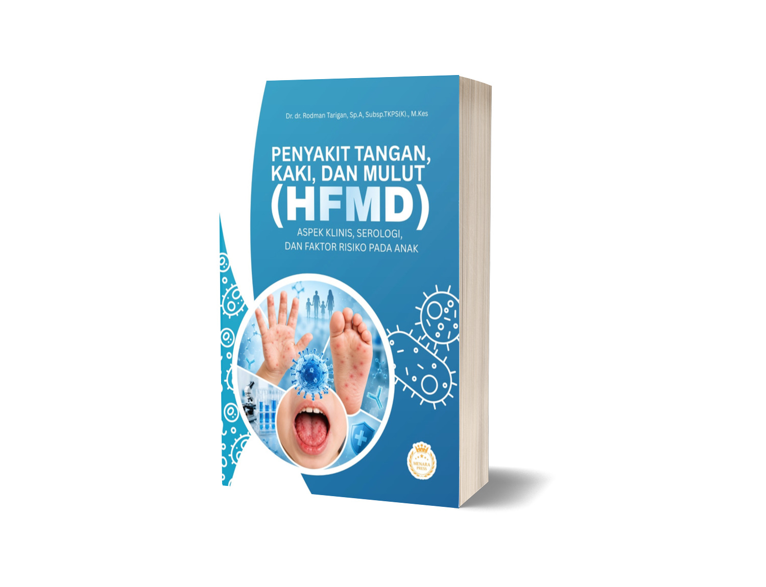 Penyakit Tangan, Kaki, dan Mulut (HFMD): Aspek Klinis, Serologi, dan Faktor Risiko pada Anak